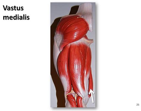 Vastus Medialis