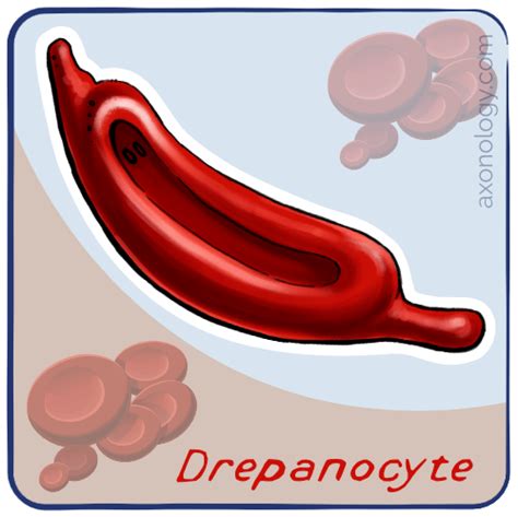 Drepanocyte - Axonology