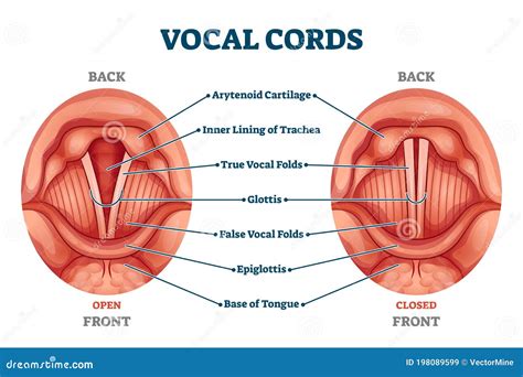 Vocal Cords Labeled Anatomical and Medical Structure and Location Scheme Stock Vector ...