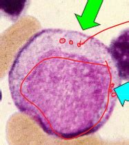 Hematology exam 2 Flashcards | Quizlet