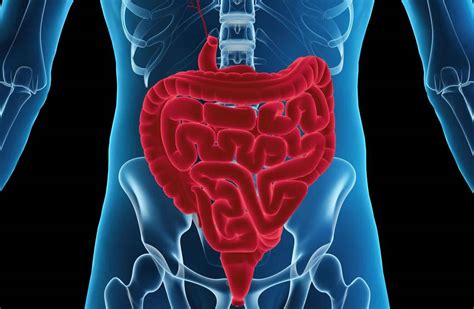 Intestinal ileus or paralytic ileus causes, symptoms, diagnosis & treatment