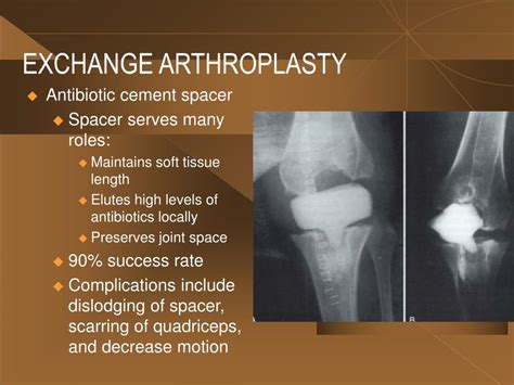 PPT - INFECTION AND TOTAL KNEE ARTHROPLASTY : DIAGNOSIS AND TREATMENT PowerPoint Presentation ...