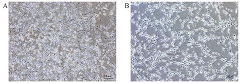 Schwann cell morphology under phase contrast microscopy. (A) Primary... | Download Scientific ...