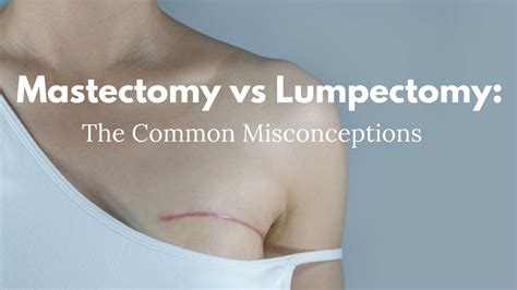 Mastectomy vs Lumpectomy: The Common Misconceptions - YouTube