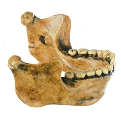 S 11 The Steinheim Skull Homo heidelbergensis | Biomedical Models