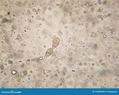 Microscopy of the Alternaria Fungus Macroconidia Stock Image - Image of conidia, life: 178382695