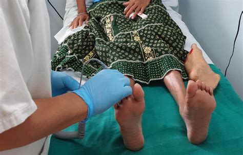 Mauritian clinics help cut diabetic foot amputations | WHO | Regional Office for Africa