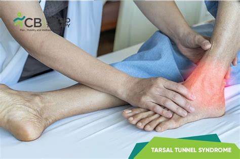 top-5-exercises-for-tarsal-tunnel-syndrome.webp