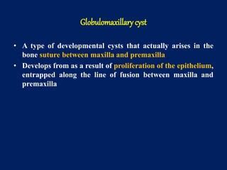 Globulomaxillary Cyst Histology