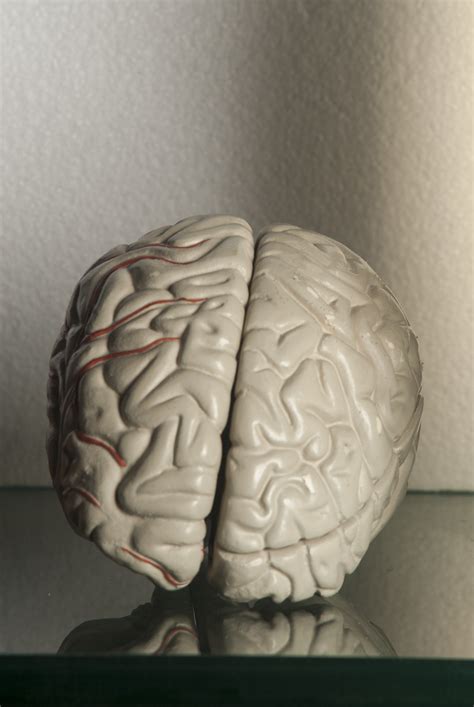 File:Human brain 01.jpg - Wikimedia Commons
