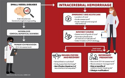 Photo | Stroke 5-17 ICH Guideline Central Illustration | American Heart Association