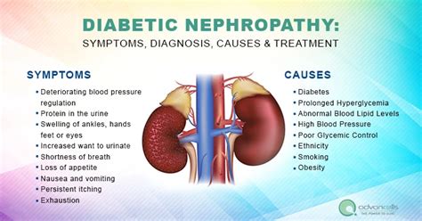 Diabetic Nephropathy: Symptoms, Diagnosis, Causes & Treatment