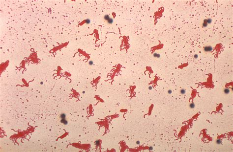 Public Domain Picture | Bacillus alvei. Leifson flagella stain. | ID: 13546612815169 ...