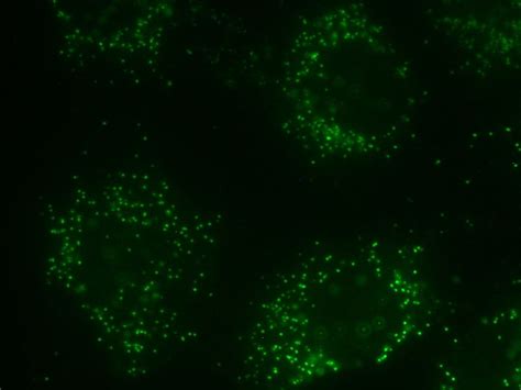 Peroxisome Function - Science Trends