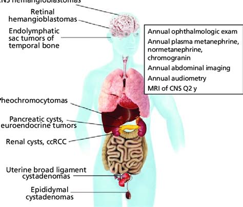 von hippel lindau disease