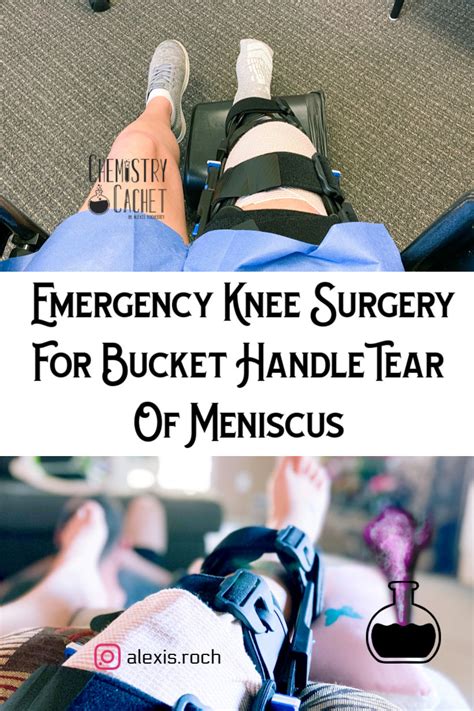 Emergency Knee Surgery For Bucket Handle Tear Of Meniscus