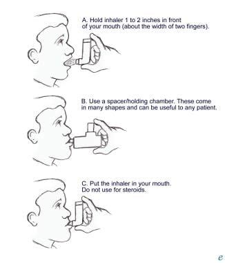 A Metered-dose Inhaler of Salmeterol Delivers Which of the Following