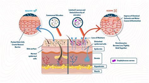 Human Skin Microbiome