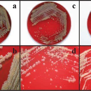 (PDF) First report of chronic implant-related septic arthritis and osteomyelitis due to ...