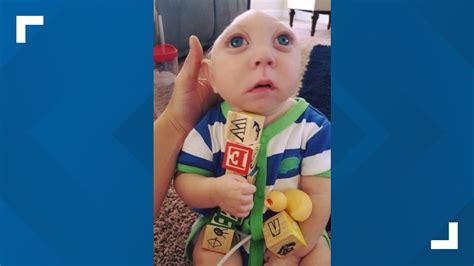 Jaxon Buell dies after years of beating the odds | firstcoastnews.com