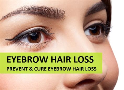 How to Prevent Eyebrow Hair Loss With Natural Remedies