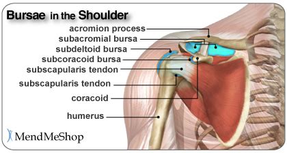 Shoulder Bursitis