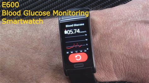 Blood Glucose Monitoring Watch Accuracy Factory Wholesaler | www.oceanproperty.co.th