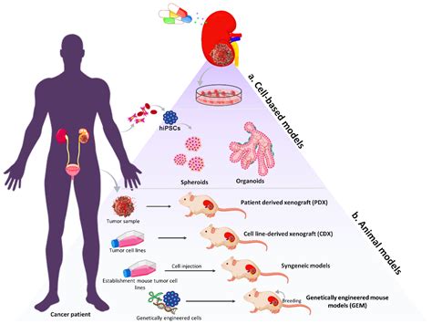 IJTM | Free Full-Text | Non-Clear Cell Renal Cell Carcinoma: Molecular Pathogenesis, Innovative ...