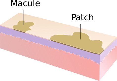 Study Medical Photos: Description Of Primary Skin Lesions