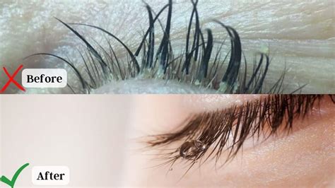 Eyelash Extensions Itchy Eyelids