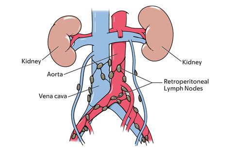 Retroperitoneal Lymph Nodes Anatomy