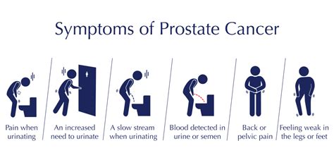 Prostate Cancer Symptoms, Diagnosis & Treatment in Sydney | Katelaris Urology