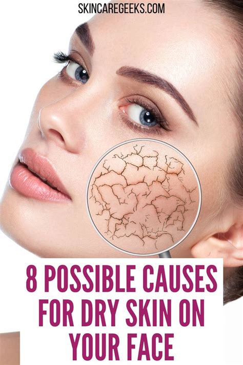 Why Is My Skin So Dry On My Face? 8 Causes & Treatments | Skin care treatments, Facial for dry ...