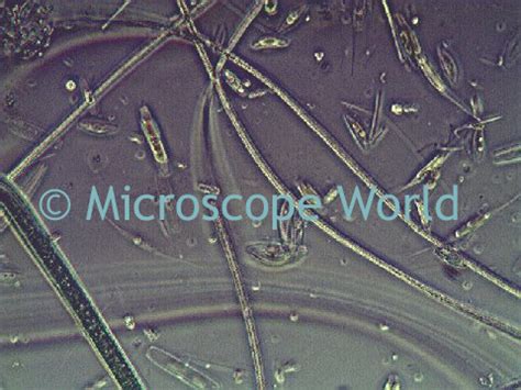 Microscope World Blog: Science Project: Microorganisms in Soil