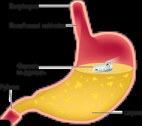 Chyme - Composition, Production, Role and Digestive Problems