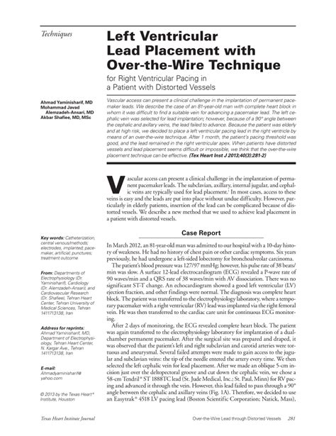 (PDF) Left Ventricular Lead Placement with Over-the-Wire Technique for Right Ventricular Pacing ...