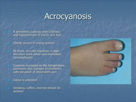 PPT - Dermatoses Resulting from Physical Factors PowerPoint ...