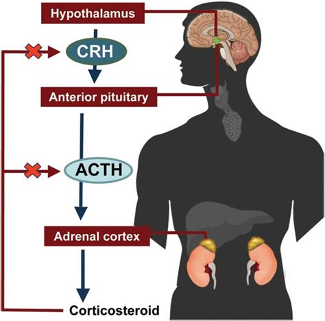 Addison's Disease Causes, Symptoms, Diagnosis, Addison's disease Diet & treament