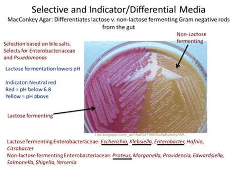 Macconkey Agar Lactose Fermentation