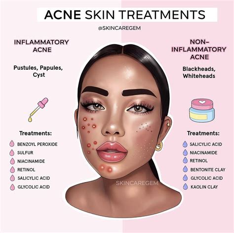 Acne Prone Skin Care, Face Skin Care, Organic Skin Care, Natural Skin Care, Natural Hair, Facial ...