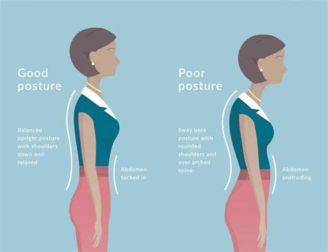 Bad Posture Causes Arthritis?!?!: Advanced Back & Neck Pain Center: Chiropractic