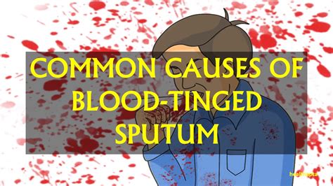 COMMON CAUSES OF BLOOD TINGED SPUTUM - YouTube