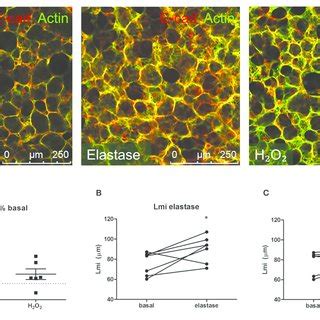 | Elastase, but not H 2 O 2 treatment increases Lmi. PCLS were exposed ...