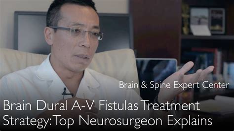 Brain dural arteriovenous fistula treatment. BDAVF. 10 – DiagnosticDetectives.Com