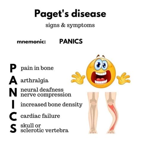 Paget’s disease - Nurses Revision