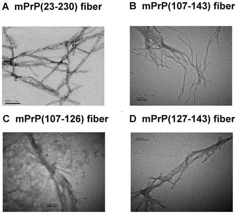 Morphology of amyloid fibrils. Transmission electron microscope images... | Download Scientific ...