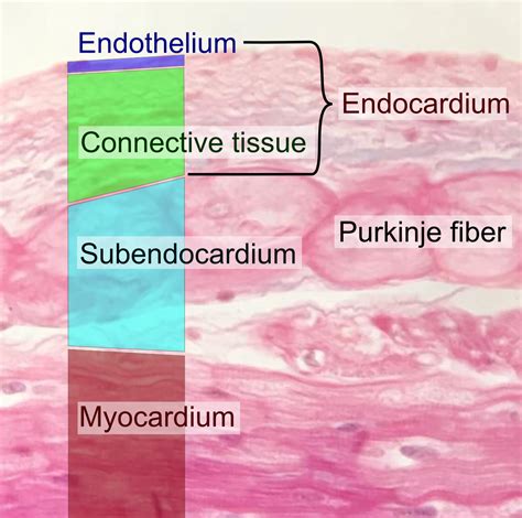 Cardiovascular Histology – UWSOM WWAMI Histopathology Thread