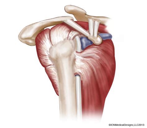 Anatomy of the Shoulder Archives - Joint Preservation Center