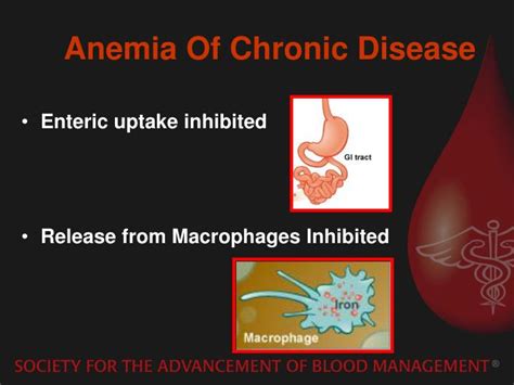 PPT - Preoperative Anemia PowerPoint Presentation - ID:1570246