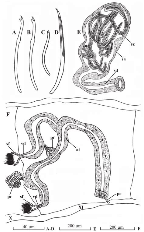 Potamothrix paramoldaviensis sp. n., A dorsal chaeta from III B ventral... | Download Scientific ...